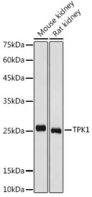 Western Blot: TPK1 Antibody [NBP2-93177] - Western blot analysis of extracts of various cell lines, using TPK1 antibody (NBP2-93177) at 1:1000 dilution. Secondary antibody: HRP Goat Anti-Rabbit IgG (H+L) at 1:10000 dilution. Lysates/proteins: 25ug per lane. Blocking buffer: 3% nonfat dry milk in TBST. Detection: ECL Basic Kit. Exposure time: 1s.